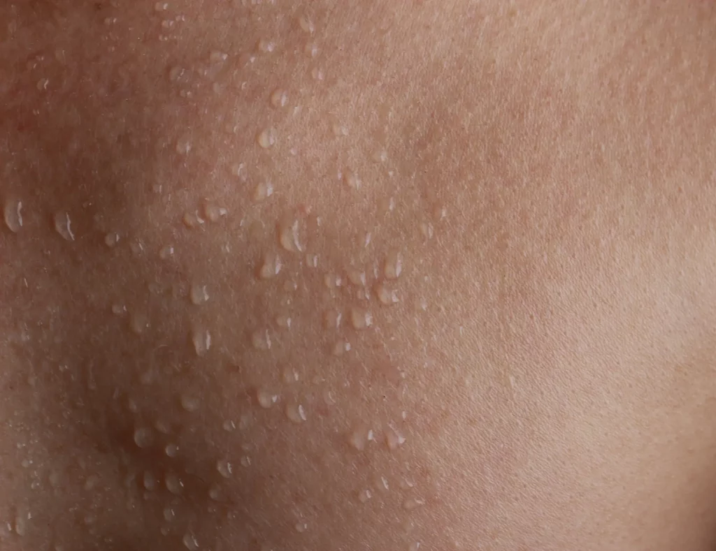 Close up on a layer of skin covered with droplets of sweat. Heated environments that cause sweating, like saunas and hot tubs, pertain to the question "What are heat shock proteins?"